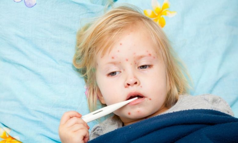 Bulgaristan’da mart ayında başlayan kızamık salgınıyla ilgili vaka sayısı yükselmeye devam ediyor.